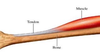 Lesiones Tendinosas