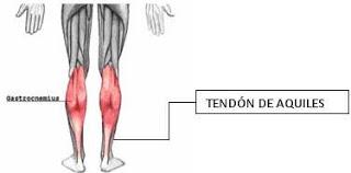 Lesiones en el tendón de Aquiles