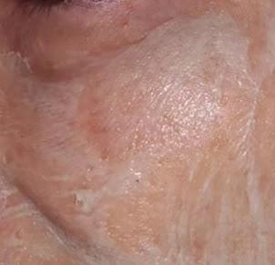 mascarilla la chinata