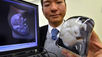 impresion 3d de ecografias