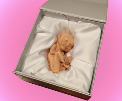 ecografia de bebes impresoras 3D