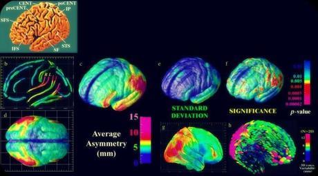 (PDF) Neuroimagen funcional en el estudio de las conductas agresivas en pacientes con esquizofrenia (PDF) Neuroimagen funcional en el estudio de las conductas agresivas en pacientes con esquizofrenia