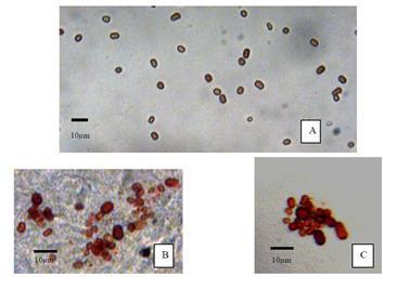 La extraordinaria historia de la lluvia roja, cometas y extraterrestres