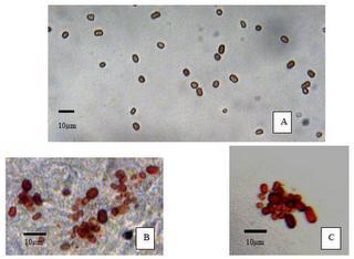 Imágenes ópticas microscópicas de las celulas rojas