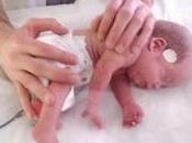 Estimulación temprana bebés prematuros