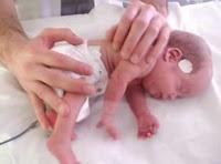 Estimulación temprana en bebés prematuros