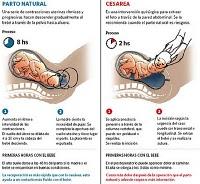 Alertan por el incremento de los partos por cesárea