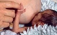 Lactancia materna en prematuros