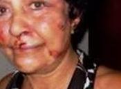 Cómo actriz contrarrevolución cubana perdió identidad Twitter