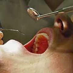 Resalta Cuba en prevención y curabilidad del cáncer bucal