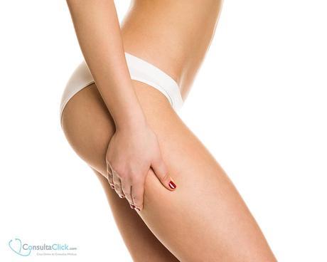 mesoterapia eliminar celulitis