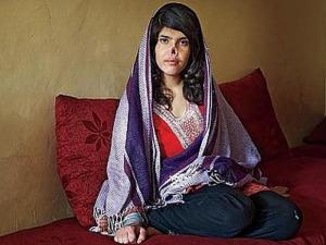 Foto de una mujer afgana mutilada por su marido que fue publicada por la revista Time