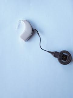 El mejor Implante Coclear