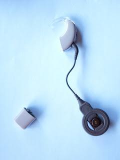 El mejor Implante Coclear