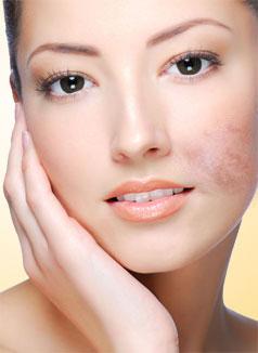 Intensive Anti-Spot Sérum de Shiseido: Review