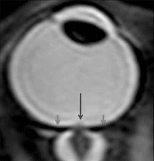 ¿Le ocurre algo a los ojos si no hay gravedad? ojo-mas-corto