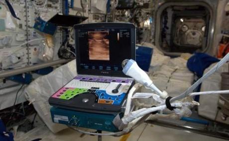 ¿Le ocurre algo a los ojos si no hay gravedad? cacharro de ultrasonidos