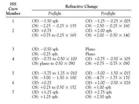 ¿Le ocurre algo a los ojos si no hay gravedad? cambios refractivos antes y despues