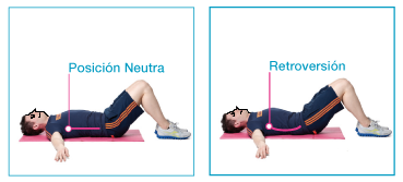 RETROVERSIÓN DE PELVIS