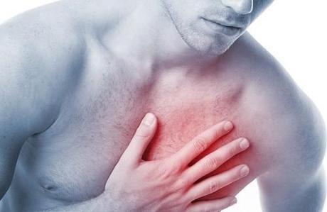 Síntomas del infarto