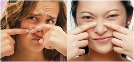 RECETA CASERA PARA ELIMINAR LAS ESPINILLAS