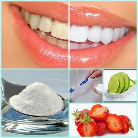 TIPS CASEROS PARA BLANQUEAR LOS DIENTES