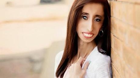 mujer fea, la mujer mas fea del mundo, superación, motivadora