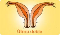 “Tengo útero bicorne”