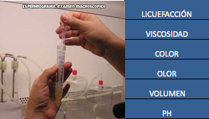 ¿ COMO QUEDAR EMBARAZADA ? UTILIDAD DEL ESPERMIOGRAMA ¿ COMO QUEDAR EMBARAZADA ? UTILIDAD DEL ESPERMIOGRAMA