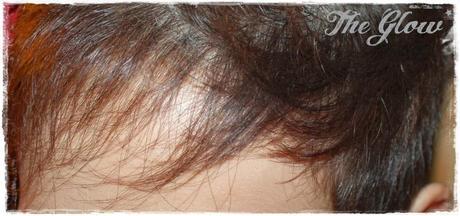 Tratamiento Milagroso