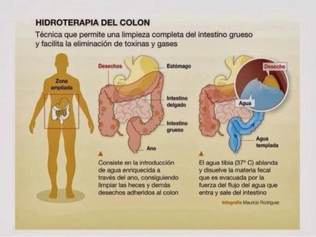 HIDROTERAPIA DEL COLON