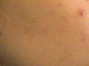 Lullage anceXpert: semana