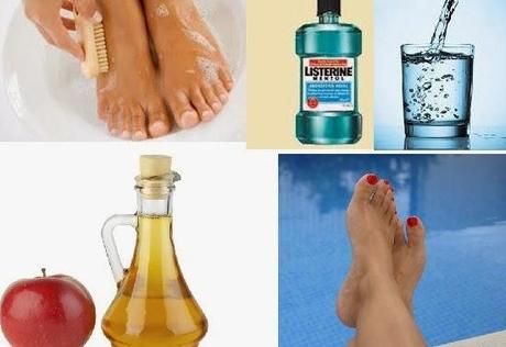 COMO ELIMINAR LOS HONGOS DE LOS PIES