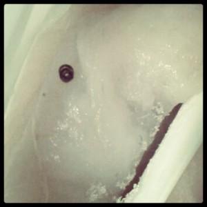 Prevención de la anisakiasis