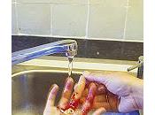 Cómo evitar infección herida niños