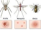 Picaduras insectos