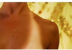 Tanoréxicos: adictos al sol