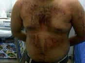 Agresión Jaime Yéspica, BRUTAL!