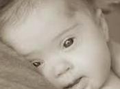 marzo celebra Mundial Síndrome Down