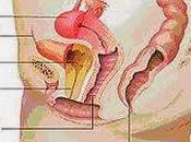 Infecciones vías urinarias mujeres