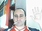 Fumar produce Calvicie