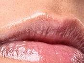¿Qué Herpes Labial?