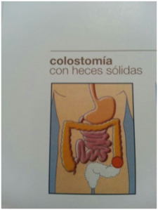 colostomía con heces solidas