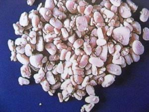 calculos_de_estruvita