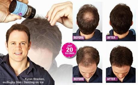 ¿Cómo tapar las calvas de forma natural?