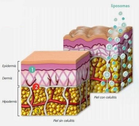 Preparamos el cuerpo para el verano: Gel Anticelulítico “Celulex” de SESDERMA