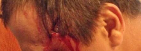 Condenado a prisión un jugador de Vigo por empujar a un rival contra una valla: Sentencia sin precedentes