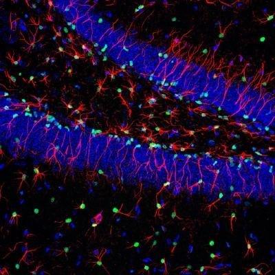 <p>Imagen de células madre cerebrales implicadas en la producción de nuevas neuronas. EFE</p> 