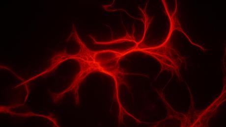 Nueva vía de reparación neuronal