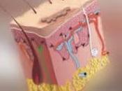 Dermatitis seborréica